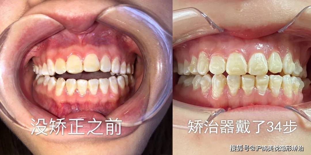 视频号如何看全，开启你的视界新体验